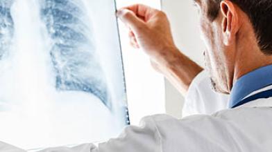 Longkanker symptonen