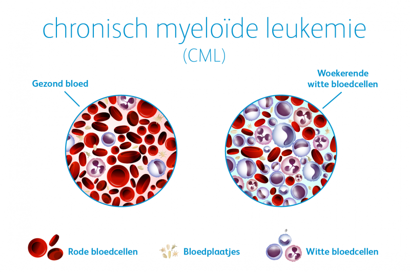 Pfizer steunt bloedkankermaand en WereldCMLDag – ben jij al stamceldonor?