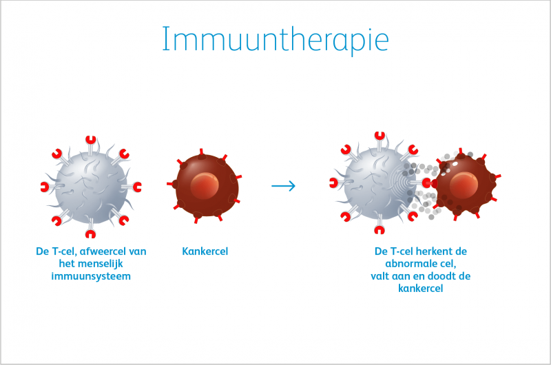 Infographic imuuntherapie