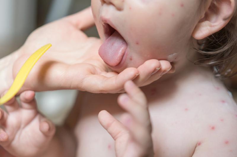 Een effectieve behandeling van kinderen met bacteriële infecties | Pfizer Nederland