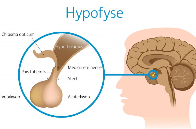 hypofese