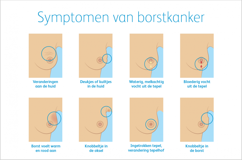 Infographic symptomen borstkanker