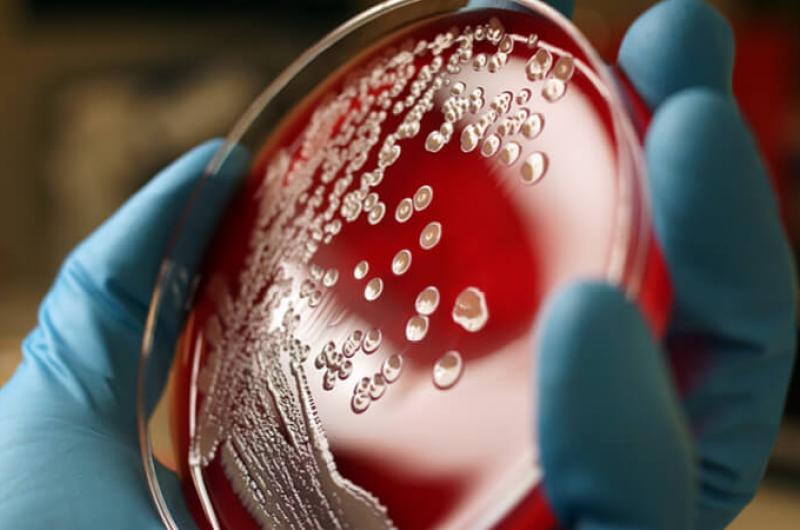 Staphylococcus aureus